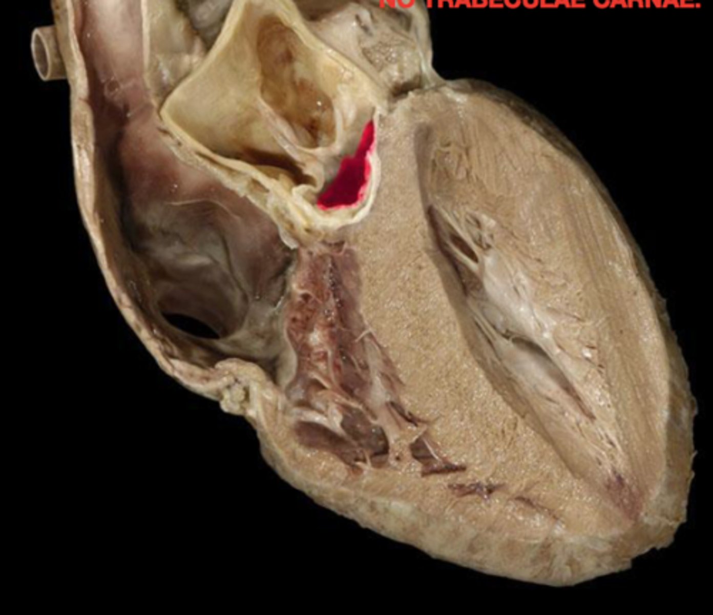 <p>probe going through the aorta</p>