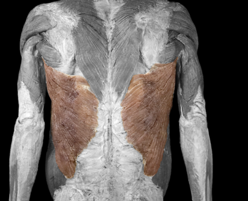 <p>What muscle is this? </p>