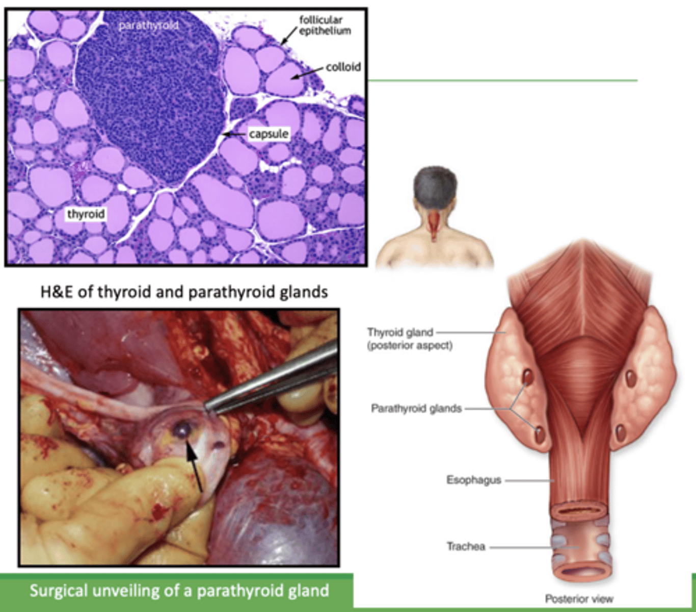 <p>parathyroid glands:</p>