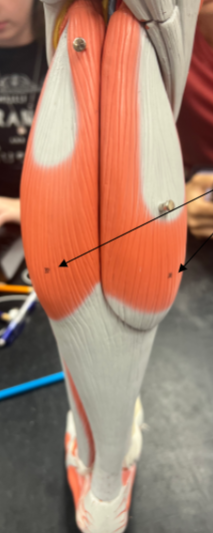 <p>what is this muscle?</p>