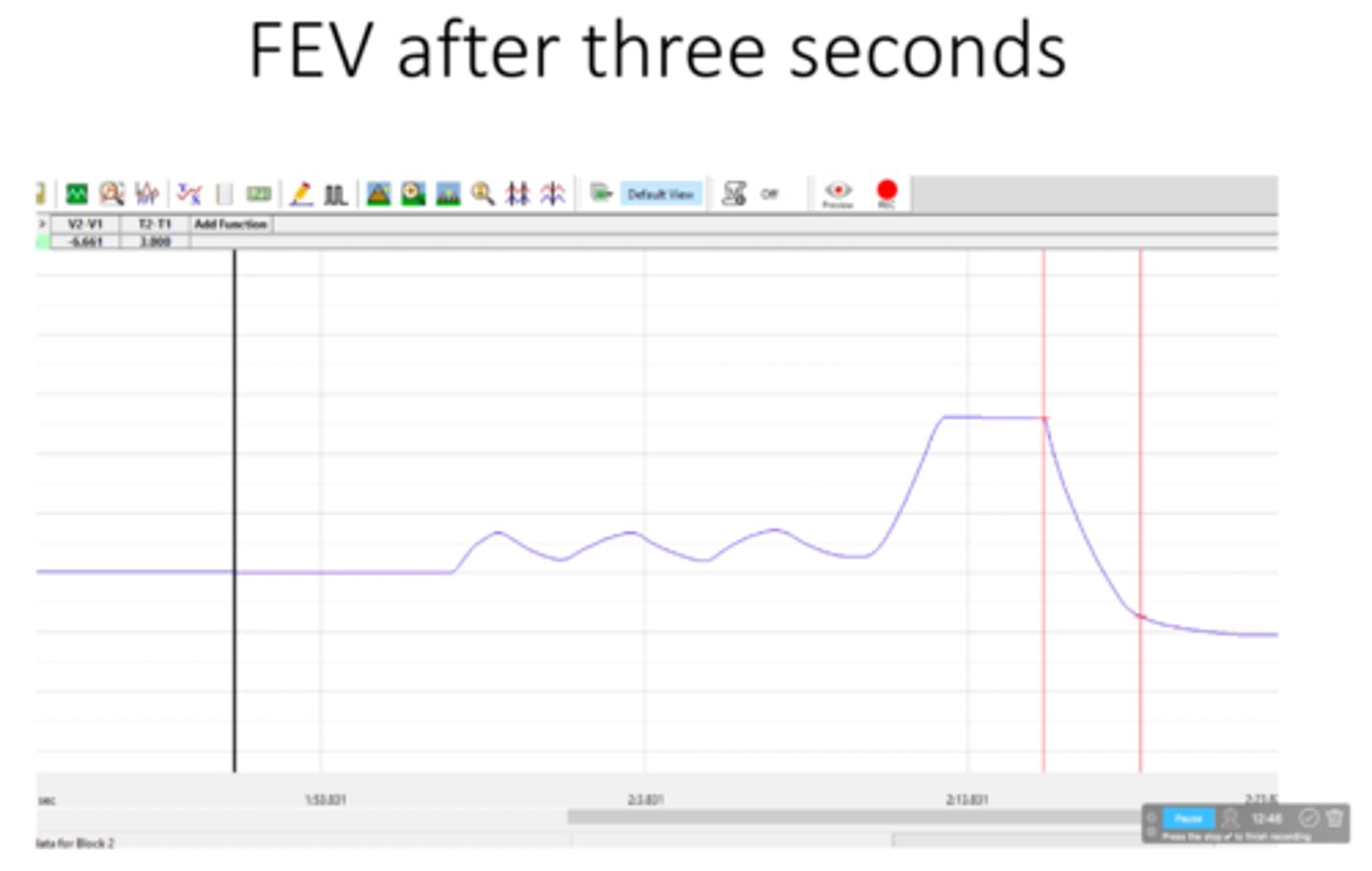 <p>What is the forced expiratory volume after 3 seconds (FEV3)? This Occurs from the start of forced exhalation until 3 seconds after</p>