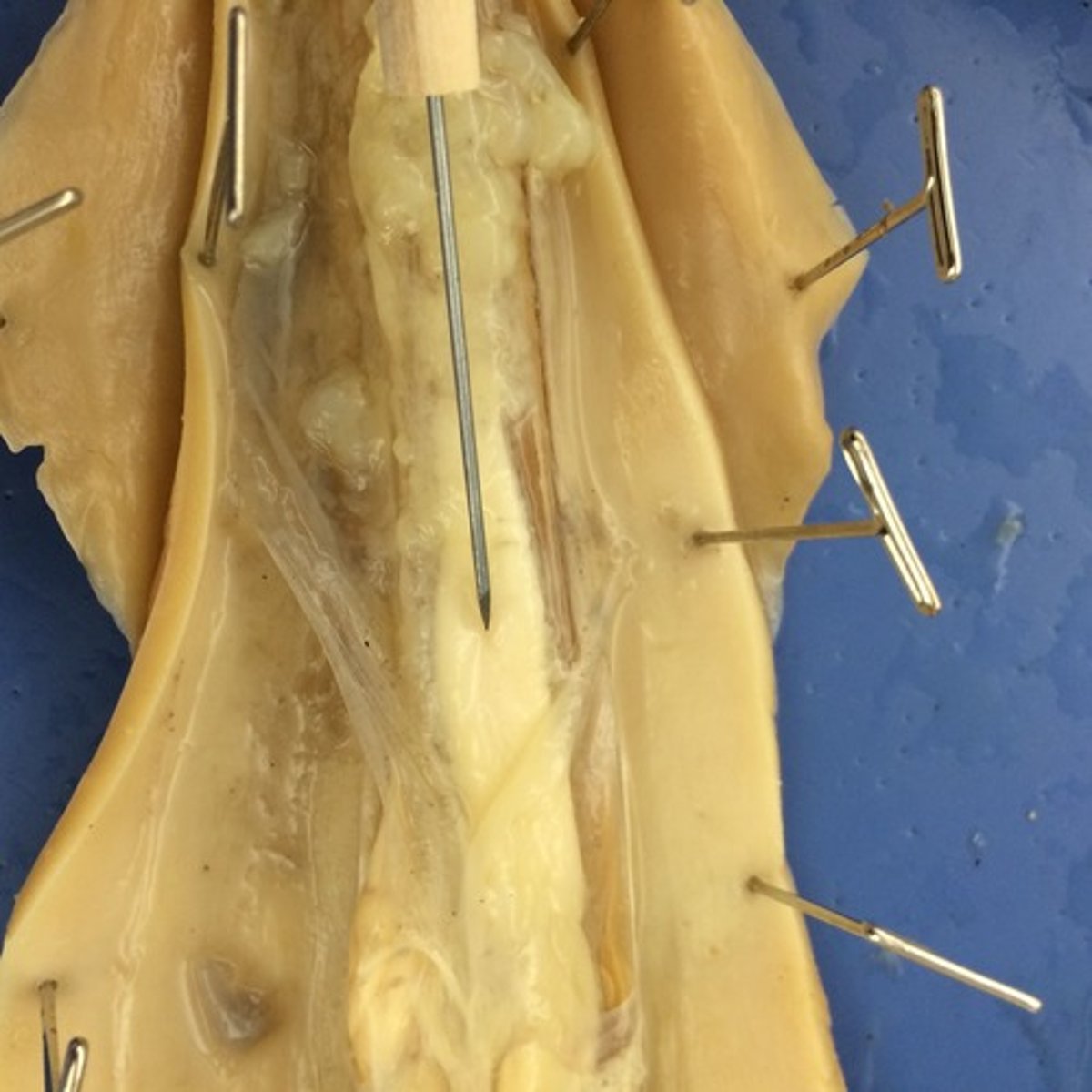 <p>This is part of the digestive system. Processed food is absorbed into the blood here.</p>