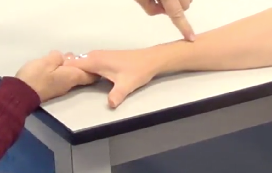 Find the snuffbox, and then follow the top tendon laterally