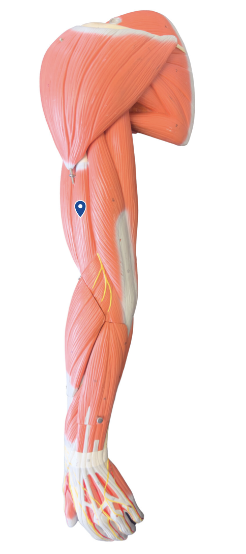 <p>What muscle is the arrow pointing to?</p>