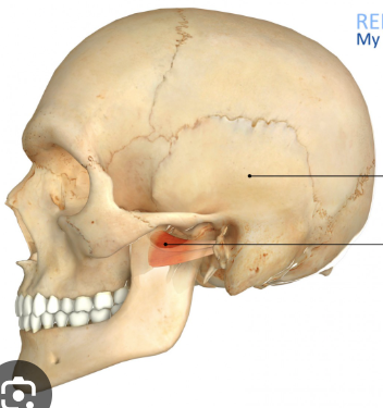 <p>what is this, its description and its appearance on images</p>