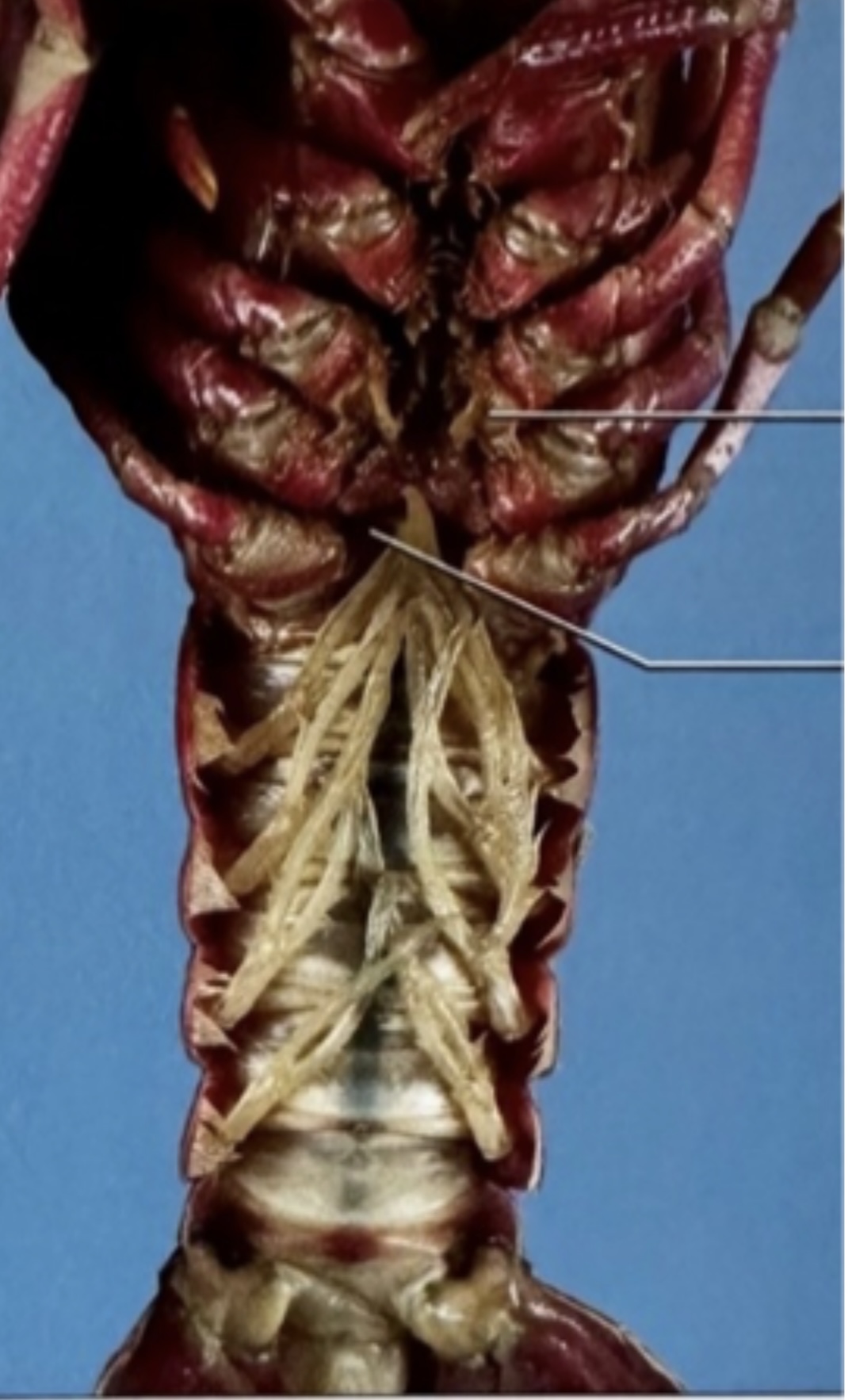 <p>Male or female </p>