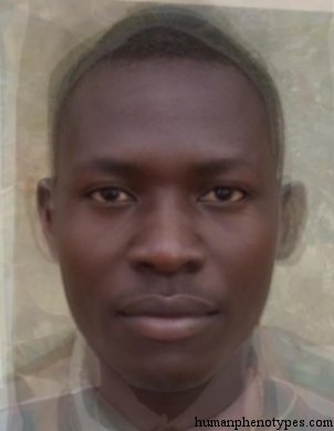 <p>Identify this Phenotype</p>