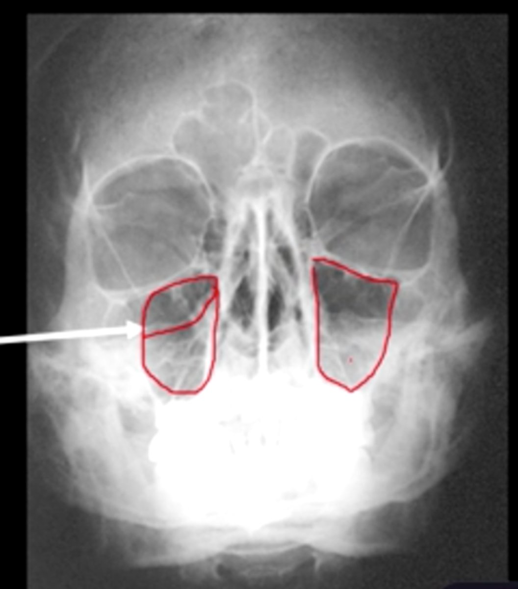 <p>What projection is this?</p>