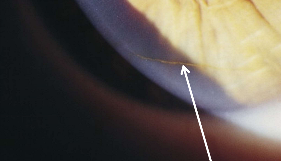 <p>What condition is this?</p>