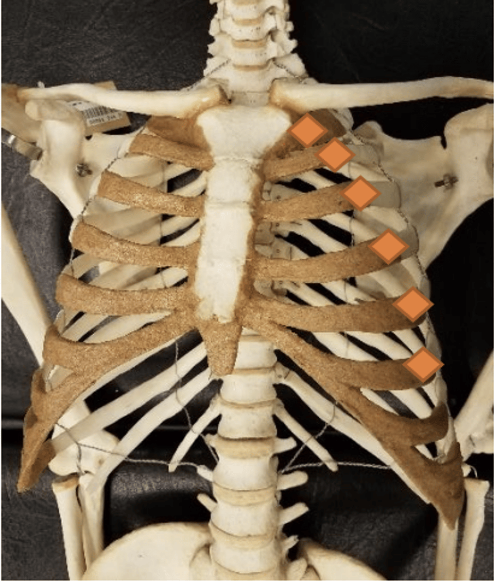 <p>first chondrosternal joint below clavicle</p>