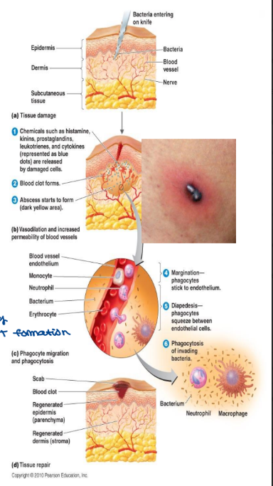 <ol><li><p>tissue damage</p></li><li><p>vasodilation</p><ul><li><p>the blood vessel dilates</p></li><li><p>more blood reaches the affected area</p></li><li><p>this allows white blood cells to access the area</p></li><li><p>brings nutrients for faster healing</p></li><li><p>this is causes redness, swelling (edema), increased temperature and pain</p></li><li><p>the pain is also due to tissue damage</p></li><li><p>this allows fibrinogen clot formation (soluble proteins present in plasma now)</p><ul><li><p>this segregates the affected area </p></li><li><p>prevents the spread of infection → blood clotting)</p></li><li><p>fibrin → insoluble mesh to plug the leakage, start clot formation</p></li></ul></li></ul></li><li><p>phagocytosis</p><ul><li><p>phagocytes destroy invading microbes</p></li></ul></li><li><p>tissue repair</p><ul><li><p>new cells are produced</p></li></ul></li></ol><p></p>