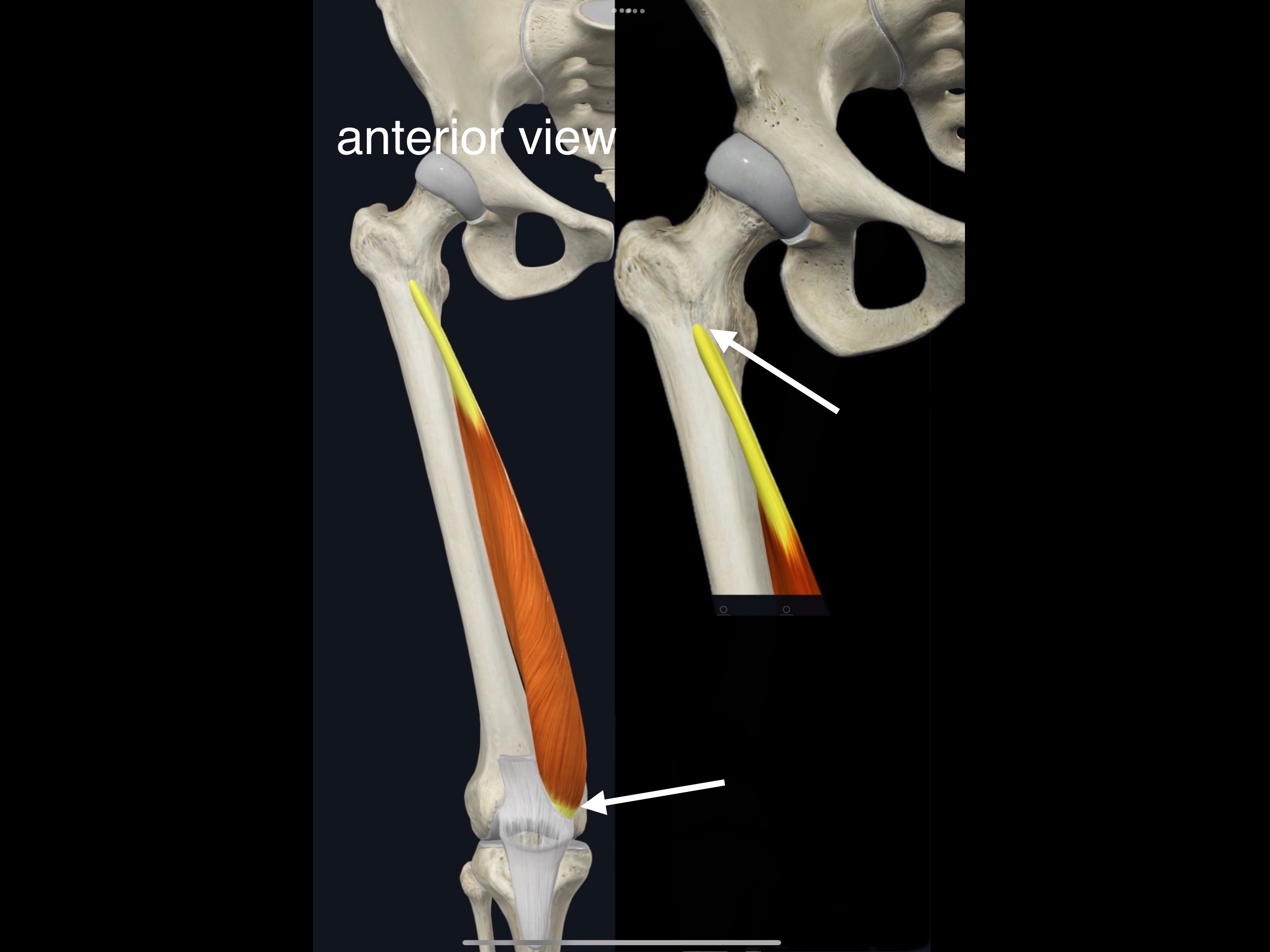 <p>Name the muscle, origin and insertion</p>
