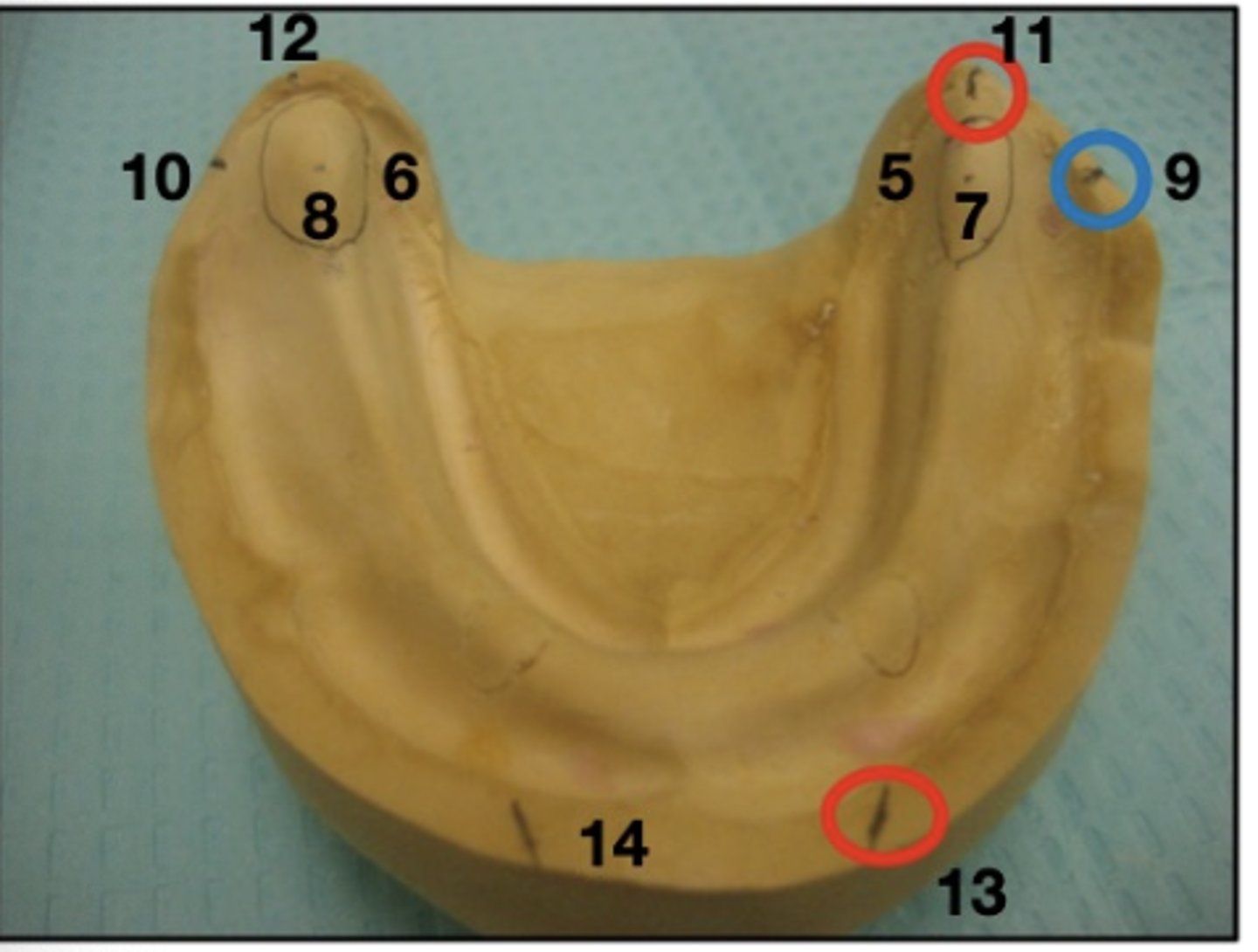 <p>What are 5 and 6?</p>