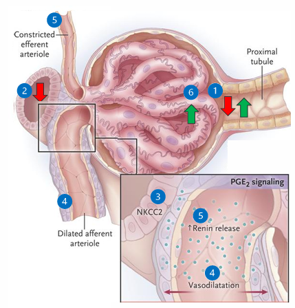 <p>1) renal perfusion drops and GFR decreases</p><p>2) filtrate NaCl flow reaching the macula densa decreases</p><p>3) sensed by the macula densa in the JGA</p><p>4) local mediators (PGE2) vasodilate the afferent arteriole</p><p>5) increased renin and increased angiotensin II results in efferent vasoconstriction</p><p>6) net effect is increased glomerular hydrostatic pressure and attempts to restore GFR (by increasing filtration fraction)</p>