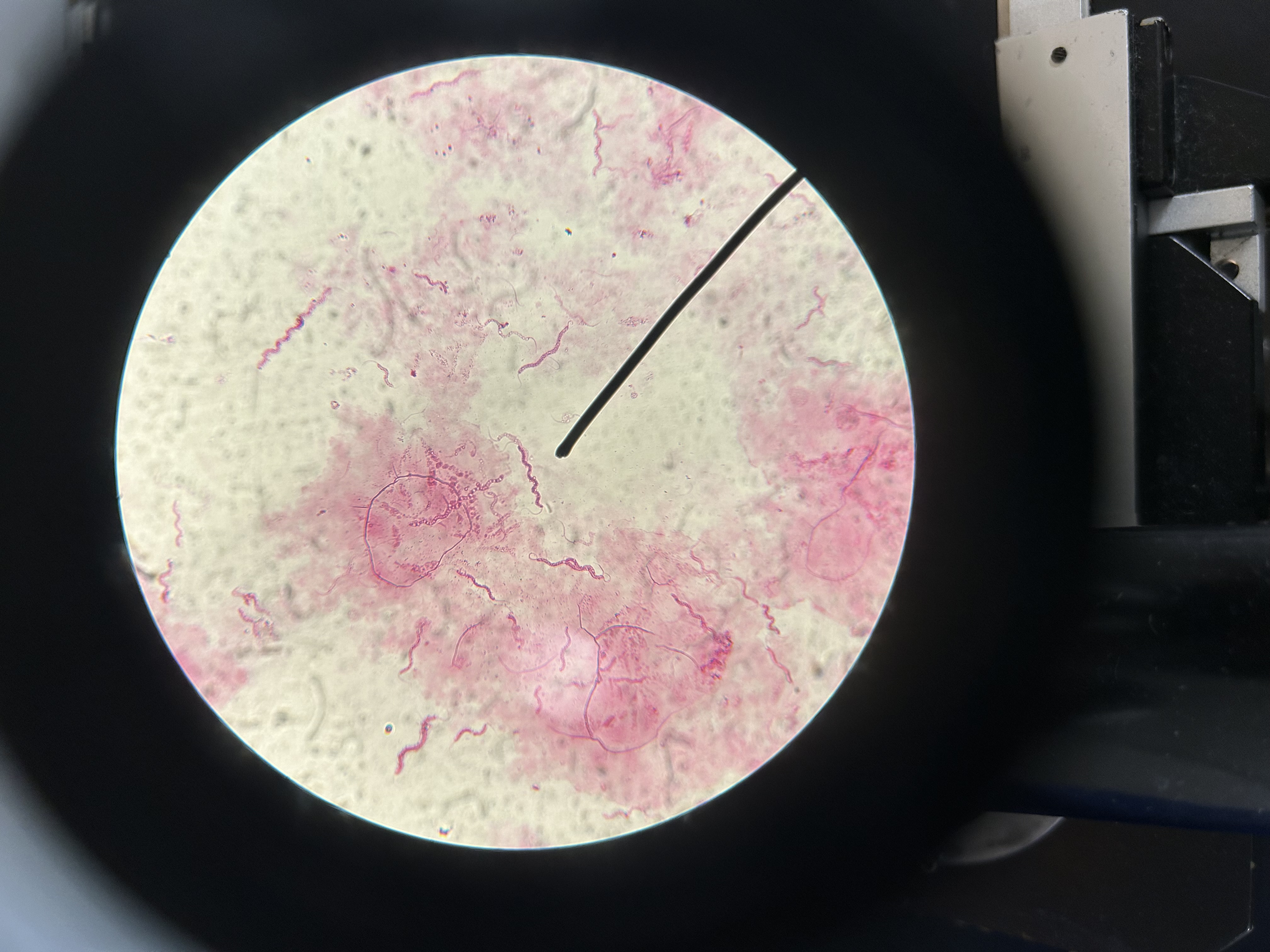 <p>Flagellated bacteria example</p>