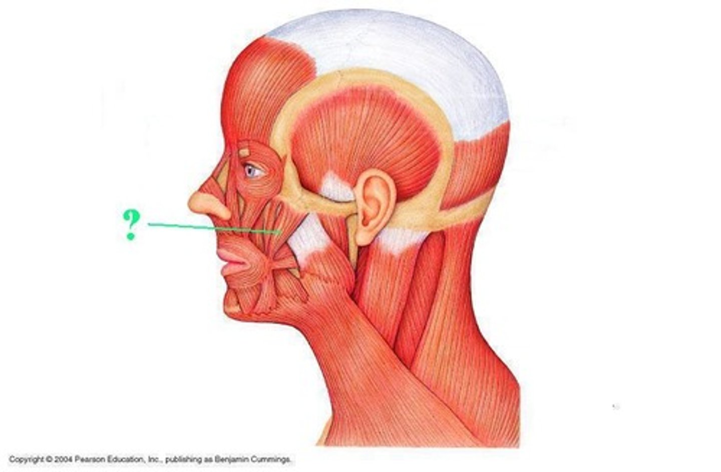 <p>Identify the indicated muscle.</p>