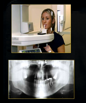 <p>to see both jaws, a panoramic radiograph can be taken </p>