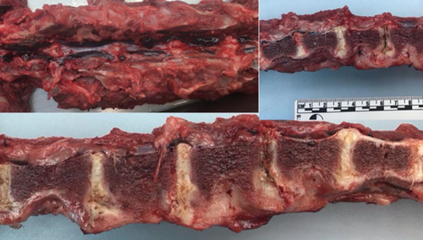 <p>Identify the pathology:</p>