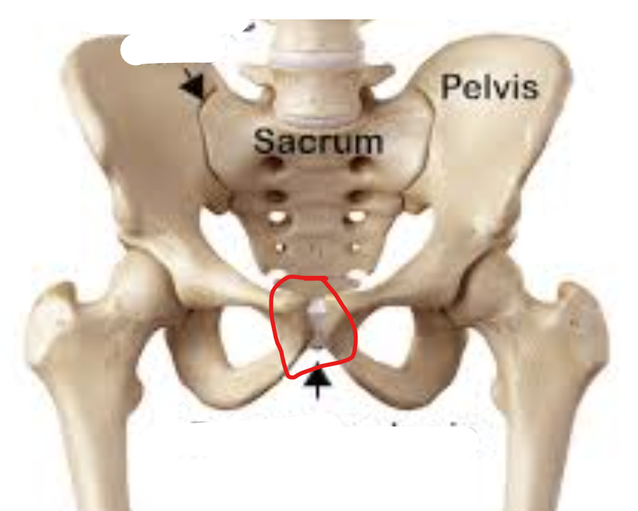 <p>what type of joint is this</p>