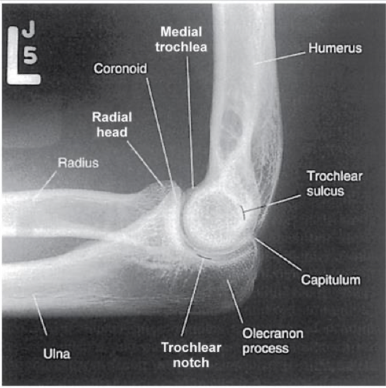<p><span style="line-height: normal;"><span>• </span></span>Three concentric arcs visible on distal humerus</p><ul><li><p class="p2"><span style="line-height: normal;"><span> </span></span>Trochlear sulcus ( small, central arc)</p></li><li><p class="p2"><span style="line-height: normal;"><span> </span></span>Capitulum ( mid-sized arc)</p></li><li><p class="p2"><span style="line-height: normal;"><span> </span></span>Medial trochlea ( largest arc, outermost)</p></li></ul><p class="p1"><span style="line-height: normal;"><span>• </span></span>Olecranon process in profile</p><p class="p1"><span style="line-height: normal;"><span>• </span></span>Humeral epicondyles superimposed</p><p class="p1"><span style="line-height: normal;"><span>• </span></span>Radial head partially superimposed over coronoid</p><p class="p1"><span style="line-height: normal;"><span>• </span></span>Radial tuberosity is superimposed over medial radial shaft</p><p class="p1"><span style="line-height: normal;"><span>• </span></span>Appropriate exposure factors</p><p class="p1"><span style="line-height: normal;"><span>• </span></span>Fat pads must be visible</p><p class="p1"><span style="line-height: normal;"><span>• </span></span>Elbow flexed 90</p>