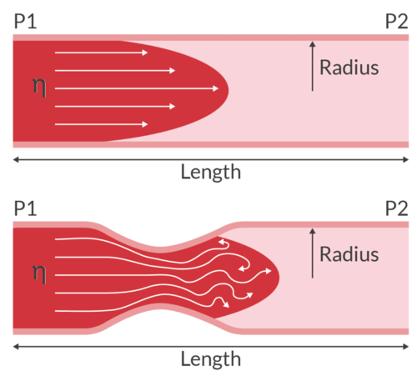 <p>molecules travel in a non-linear path and will create eddies</p><p>When flow is turbulent, lots of neergy is lost to heat and virbrations. (can produce a mumur)</p>