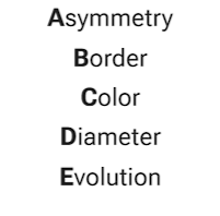 <p><br>Asymmetry</p><p>Border</p><p>Color</p><p>Diameter</p><p>Evolution</p>