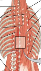 <p>Interspinales are…</p>