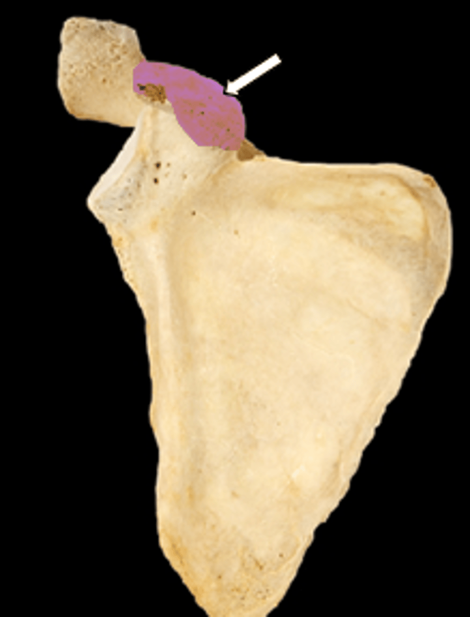<p>name the part</p>