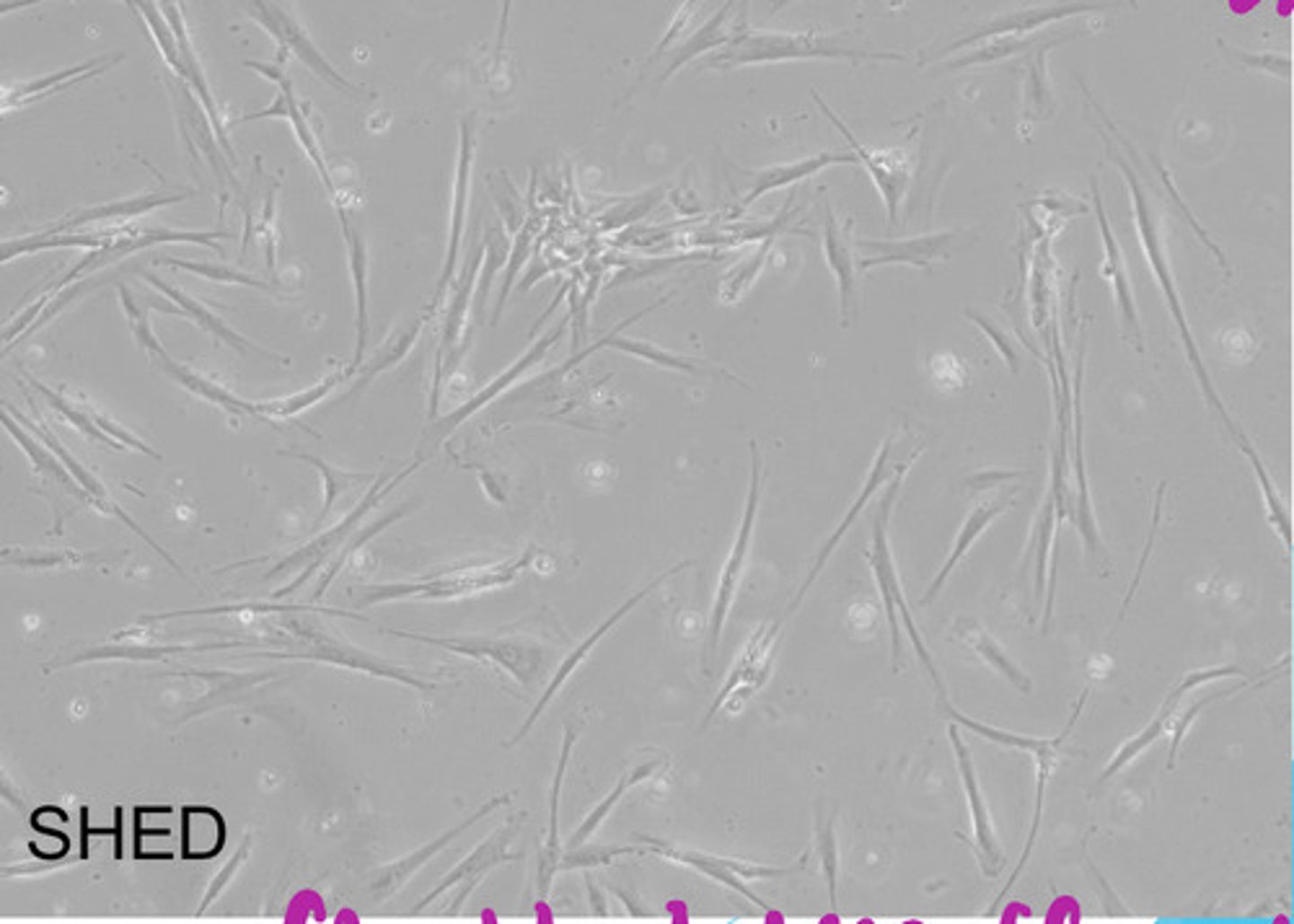 <p>stem cells isolated from the pulp remanent of exofoliated deciduous teeth <br> -greater proliferation rate &amp; higher capability for differentiation than BMSCs &amp; DPSCs<br> -can differentiate into osteoblasts, odontoblasts, adipocytes, &amp; neuronal cells <br><br>*fibroblast-like appearance</p>