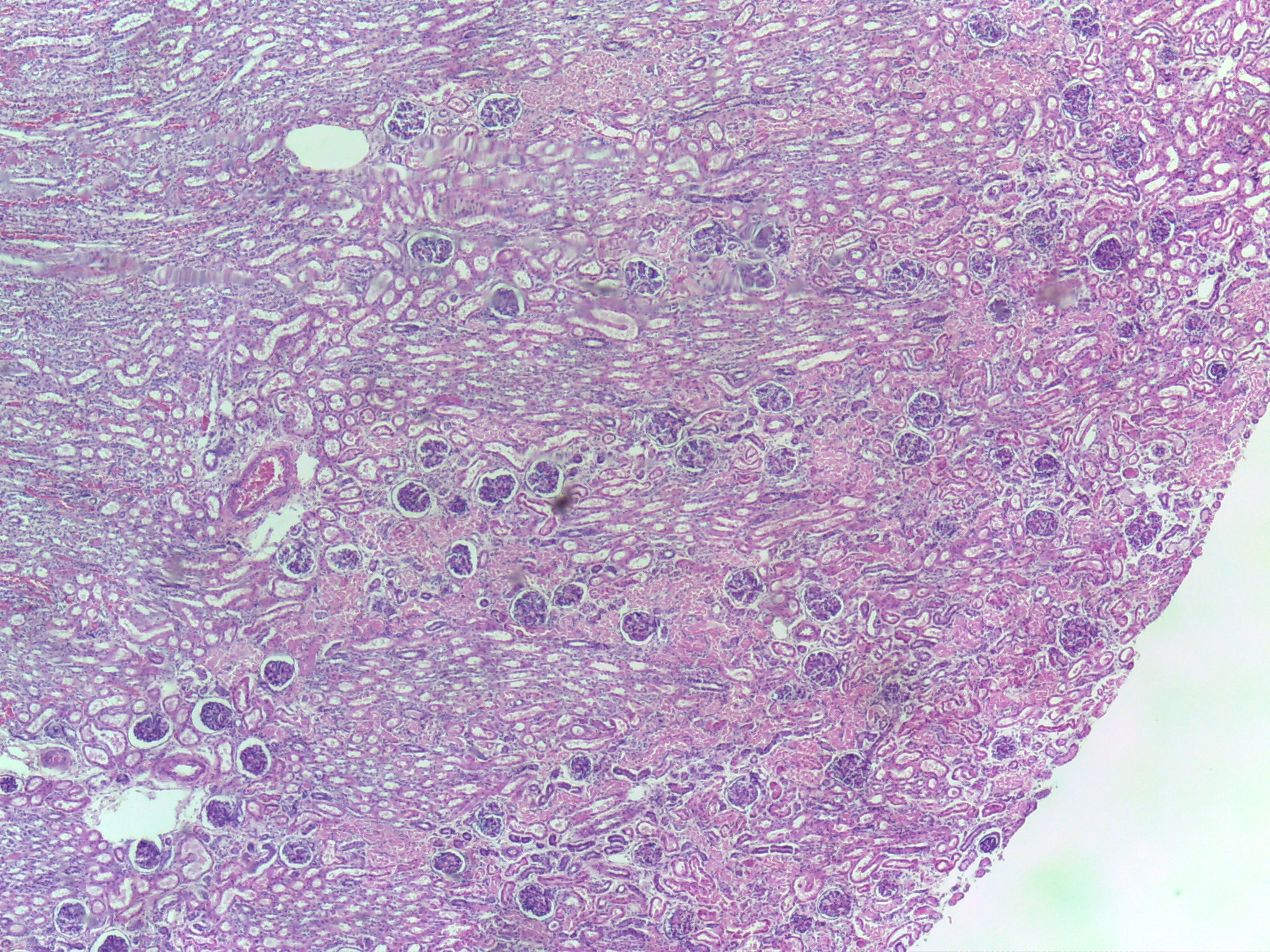 <p>Kidney</p>