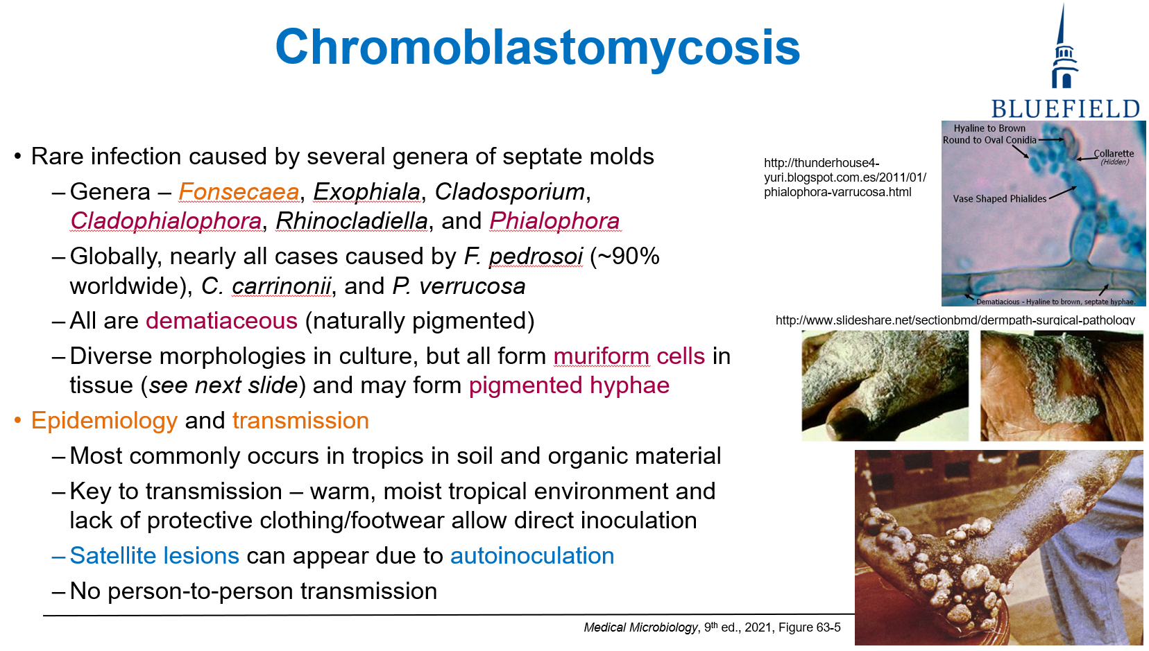 <p>C. Tropical, humid regions<br></p><p><strong>Chromoblastomycosis</strong> is found in <strong>tropical, humid</strong> areas and often acquired via <strong>skin inoculation</strong>.</p>