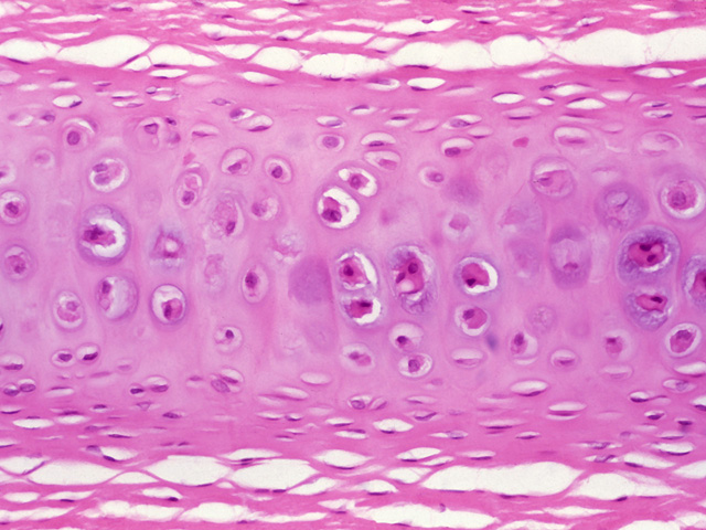 <p>What is this tissue?</p>