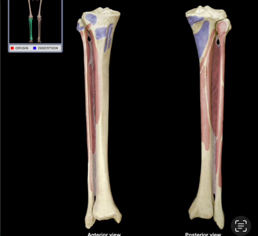 <p>What is the name of the bone?</p>