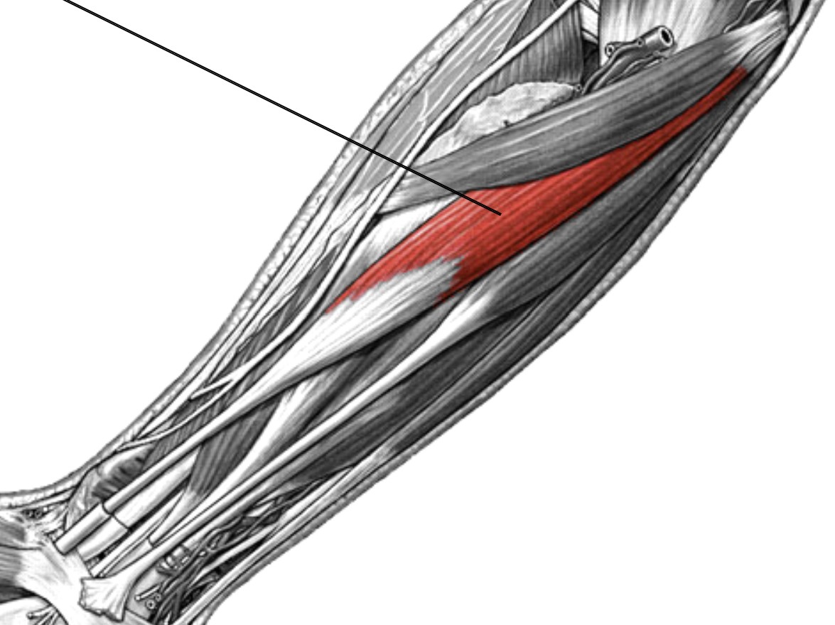 <p>Which muscle of the forearm is:</p><ul><li><p>Deep to pronator teres, anterior forearm</p></li><li><p>Action: flex &amp; abducts wrist</p></li><li><p>Nerve: median</p></li></ul><p></p>