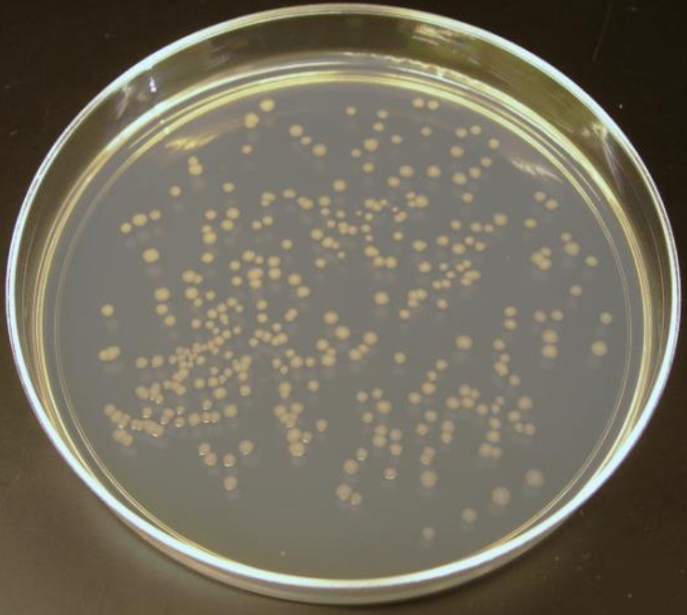 <ul><li><p>c<span>olonies <mark data-color="blue" style="background-color: blue; color: inherit">uniformly distributed throughout solid medium</mark> when appropriate sample dilution is plated </span></p></li></ul>