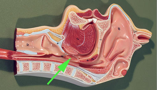 <p><span>The structure marked by the green arrow is a <strong>palatine</strong> tonsil</span></p>