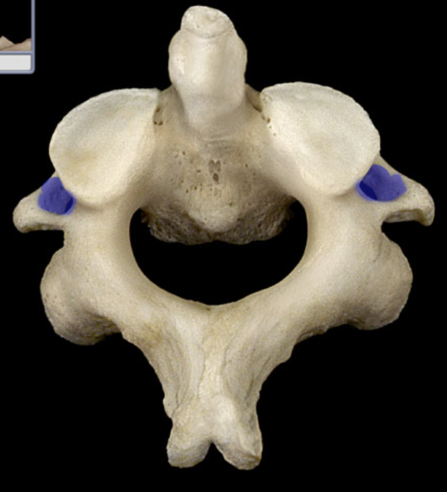 <p>(top - anterior)</p>