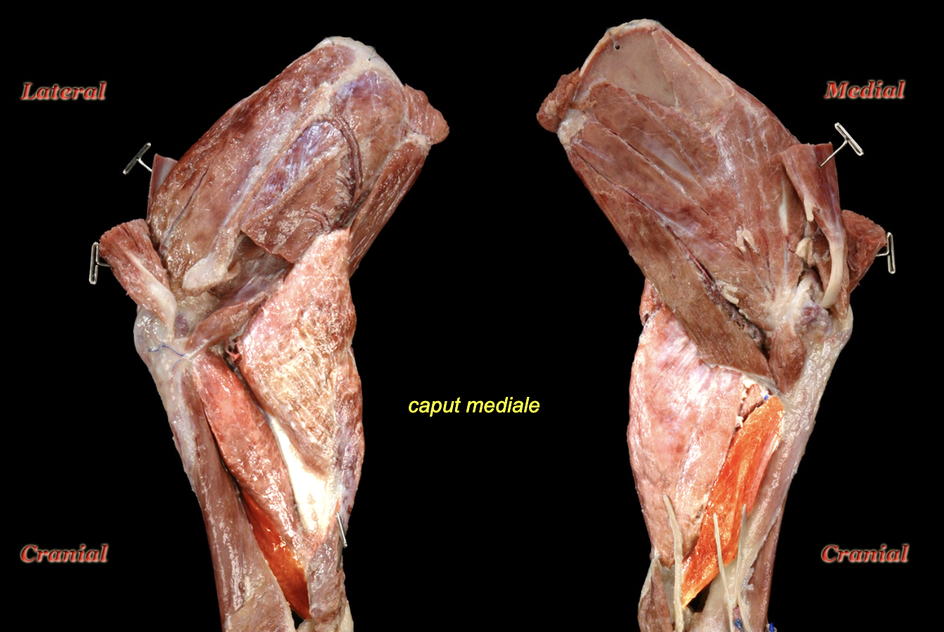 <p>Medial head of the triceps brachii m.</p>