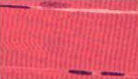 <p><strong>Muscle tissue</strong> consists of:</p>