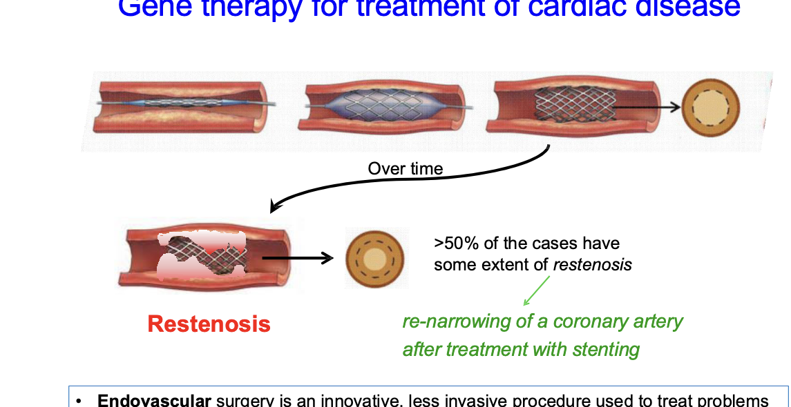 <ul><li><p><strong>endovascular</strong> surgery = innovative, less invasive procedure used to treat problems affecting the blood vessels</p><ul><li><p>blocked artery is opened using a stent → keeps artery open, restoring blood flow</p></li><li><p>over time, &gt;50% of patients, artery narrows again in process called <strong>restenosis = common adverse event of endovascular procesdures</strong></p></li></ul></li></ul><p></p>