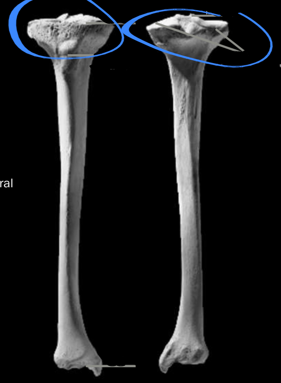 <p>Colloquially referred to as the shin bone, located on the tibia, articulated with the knee</p>