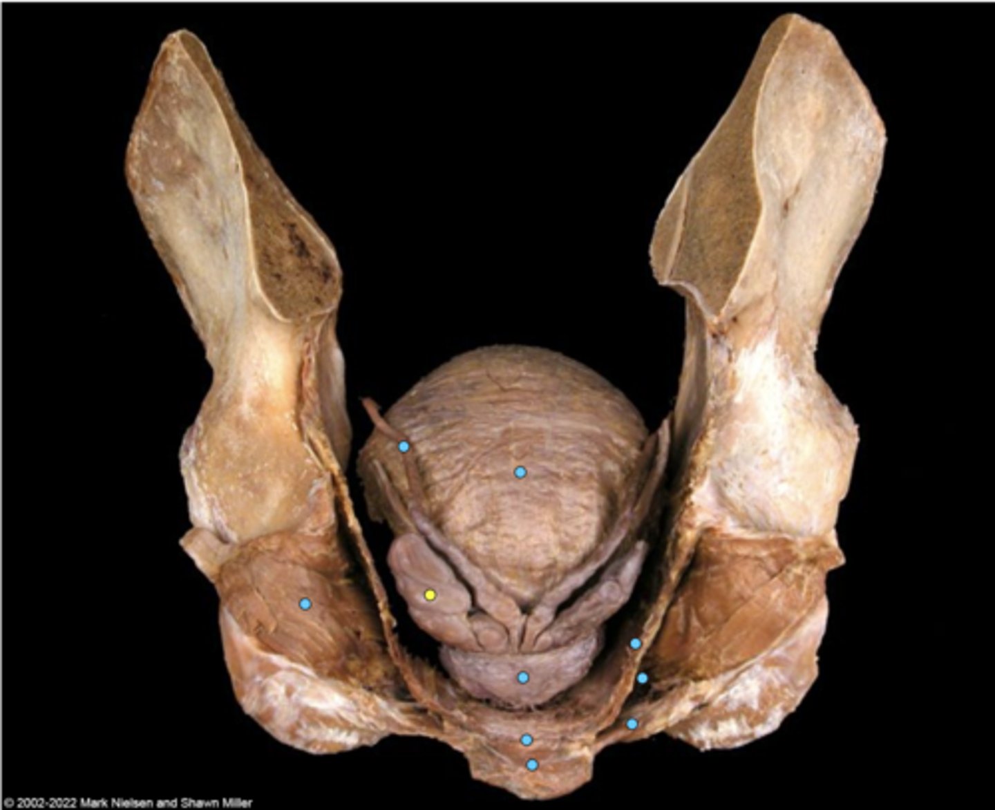knowt flashcard image