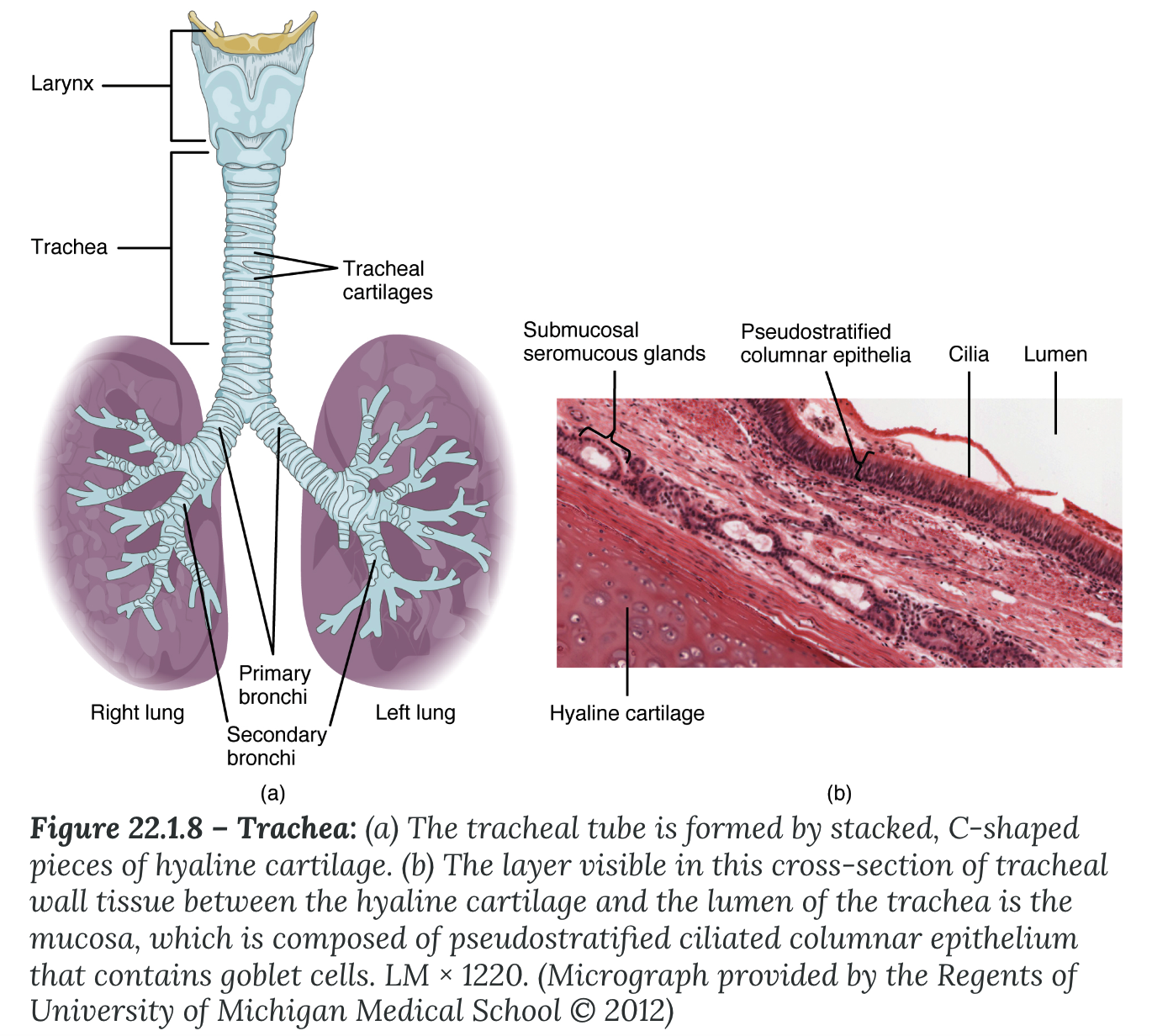 <p><strong>Trachea</strong></p><ul><li><p>AKA _____</p></li><li><p>extends from the larynx toward the lungs</p></li><li><p>formed by 16-20 stacked, C-shaped pieces of _____ cartilage that are connected by dense connective tissue</p></li><li><p><strong>________ muscle</strong></p><ul><li><p>trachealis muscle + elastic connective tissue</p></li><li><p>connects the C-shaped cartilages</p></li><li><p>allows the trachea to stretch and expand slightly during inhalation and exhalation</p></li></ul></li><li><p>lined with ___________ ciliated columnar epithelium, which is continuous with the larynx</p></li></ul>