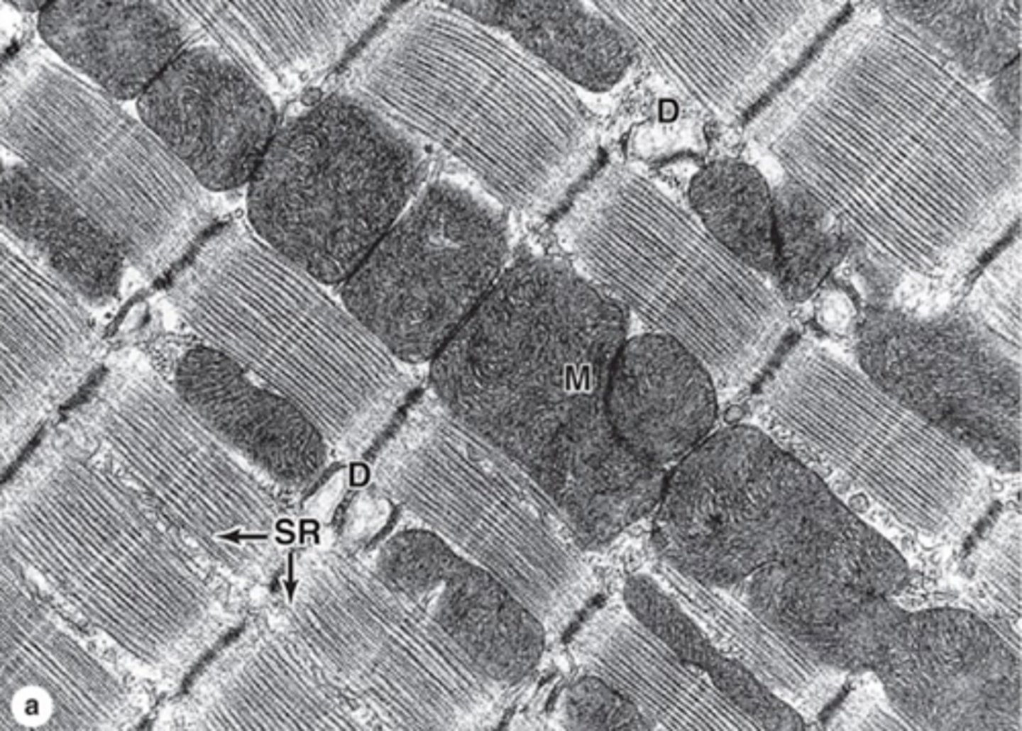 <p>Ultrastructure of cardiocytes reveal what features?</p>