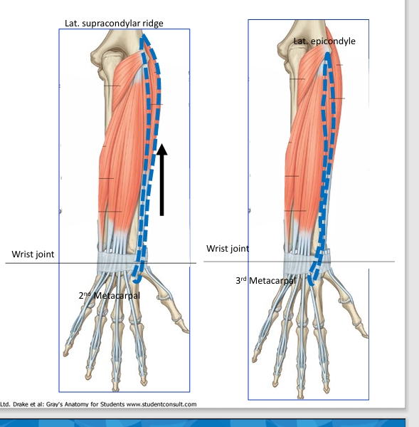 <p>Name this muscle</p>