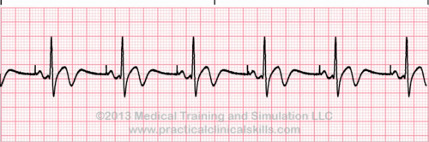 <p>what is this ekg</p>