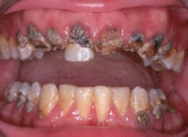 <p>what does this clinical image show</p>