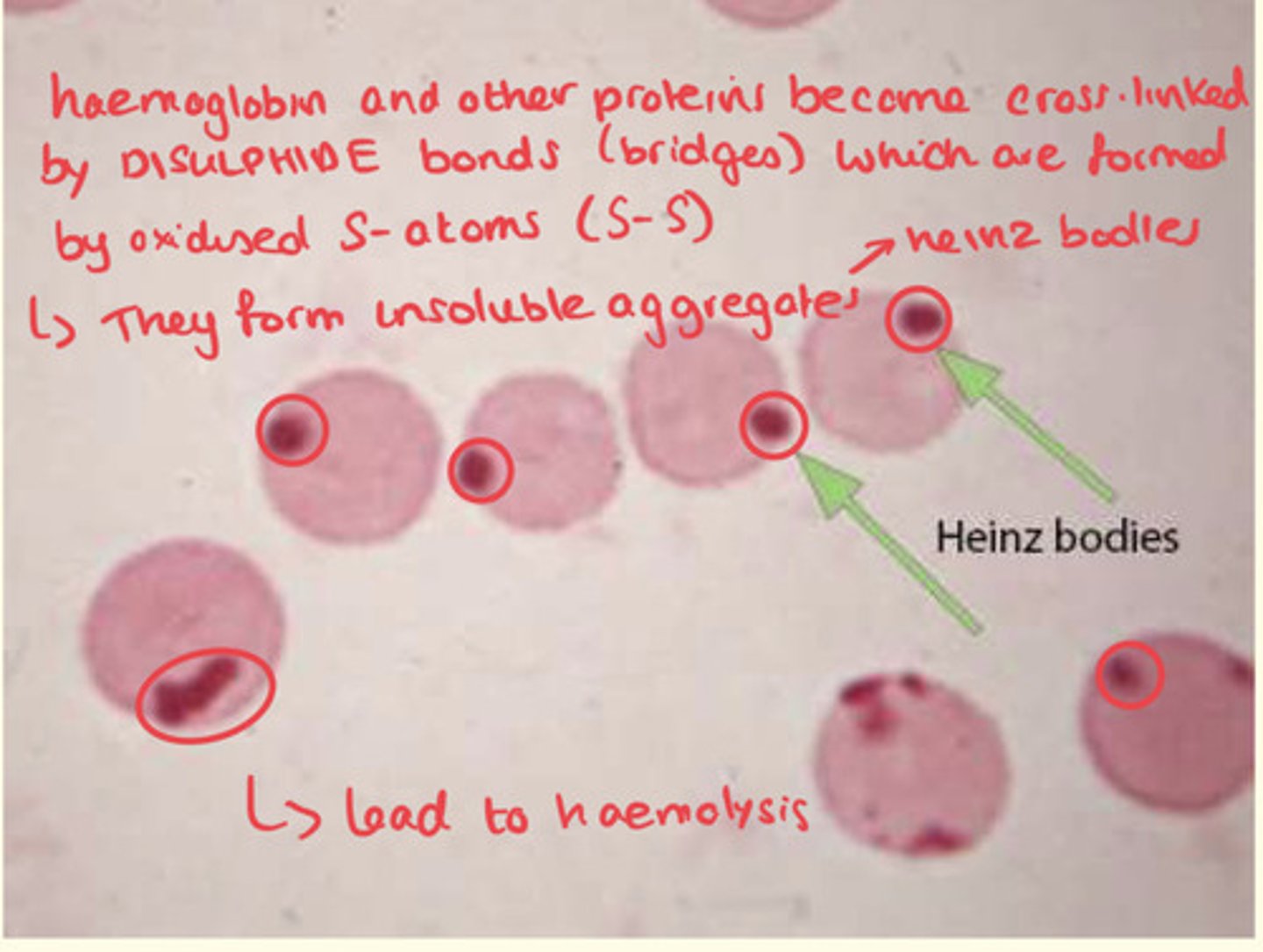 <p>Haemolysis by the spleen</p>