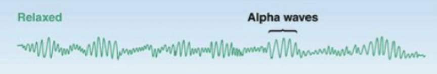 <p>what state of wakefullness/ sleep does this EEG depict?</p>