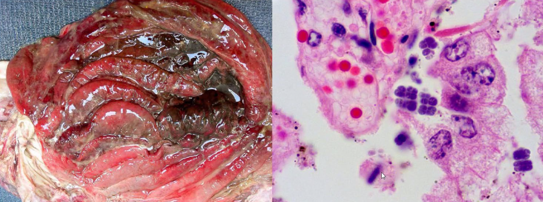 <p>A-Clostridium septicum</p><p>B-Eimeria bovicu/i</p><p>C-Coccidioides spp.</p><p>D-Sarcinia spp.</p>